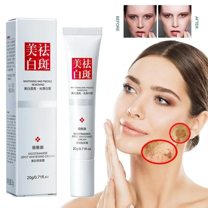 Skincare Niacinamide - จางลงกระจุดด่างดําครีม Niacinamide ครีมวิตามิน E ปรับปรุงความหมองคล้ํา Fast