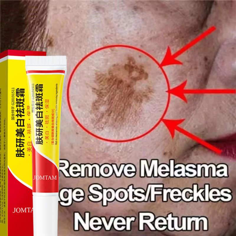 Skincare Niacinamide - ไวท์เทนนิ่งเฟรคเคิลครีม ครีมบำรุงผิวหน้าไนอาซินาไมด์ ลดฝ้า กระ จุดด่างดำ เมลานิน