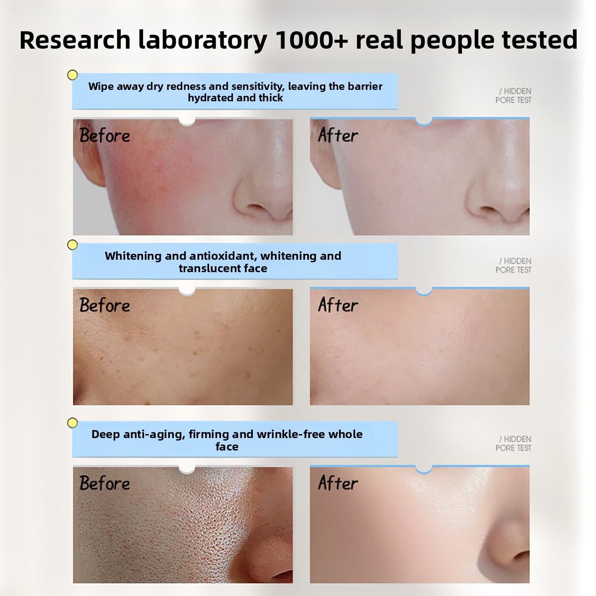 ครีมบำรุงผิวหน้า รุ่ยอี้ วิตาม - Skincare Niacinamide บทวิจารณ์และราคา