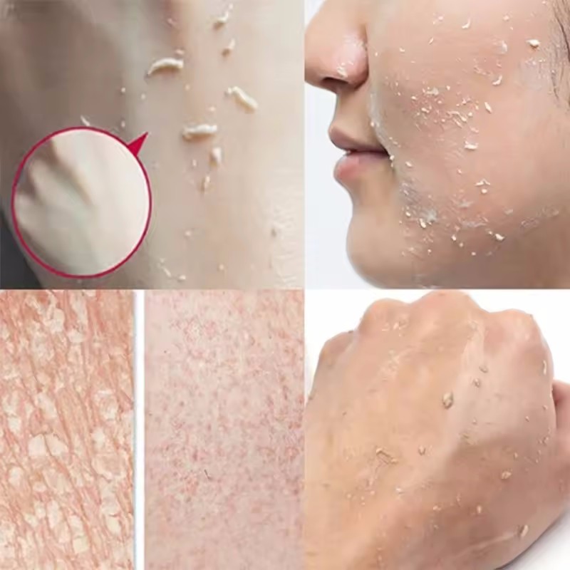 Orange Exfoliating Peeling Gel - Ceramide Moisturizer บทวิจารณ์และราคา