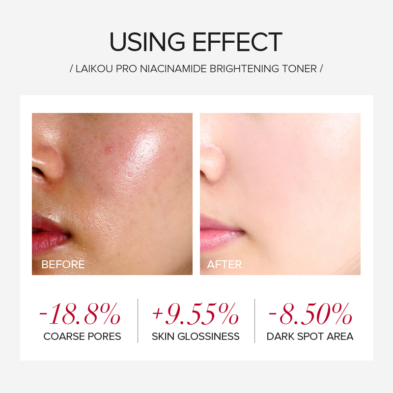LAIKOU PRO ไนอาซินาไมด์ ชุดผลิ - Skincare Niacinamide บทวิจารณ์และราคา