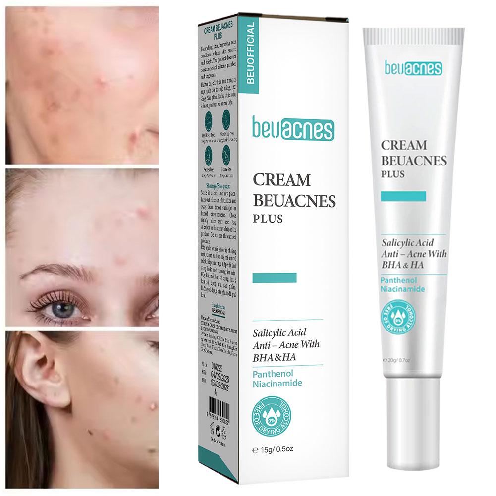 ใหม่ 20g Niacinamide Acne Gel  - Skincare Niacinamide บทวิจารณ์และราคา