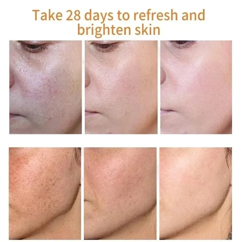 จางลงกระจุดด่างดําครีม Niacina - Skincare Niacinamide บทวิจารณ์และราคา