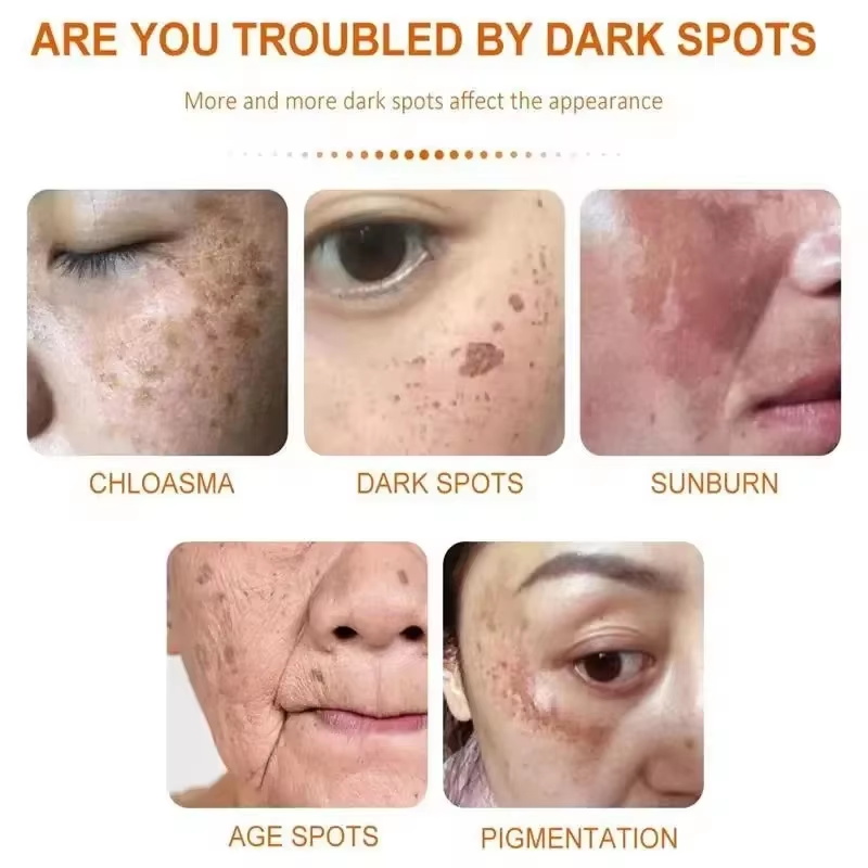 ไวท์เทนนิ่งเฟรคเคิลครีม ครีมบำ - Skincare Niacinamide บทวิจารณ์และราคา