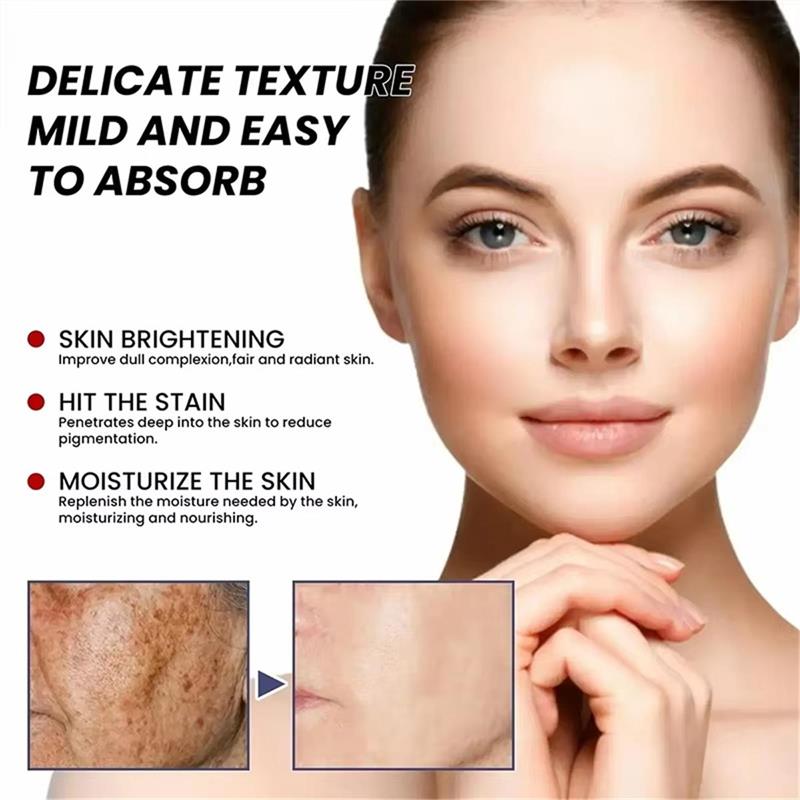 ไวท์เทนนิ่งเฟรคเคิลครีม ครีมบำ - Skincare Niacinamide บทวิจารณ์และราคา